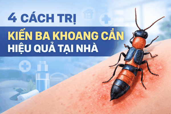 4 Cách Trị Kiến Ba Khoang Cắn Hiệu Quả Nhất Tại Nhà