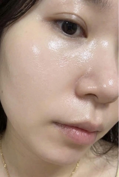 Bỏ 5 triệu để đổi lấy làn da láng mịn thế này có xứng không ạ?