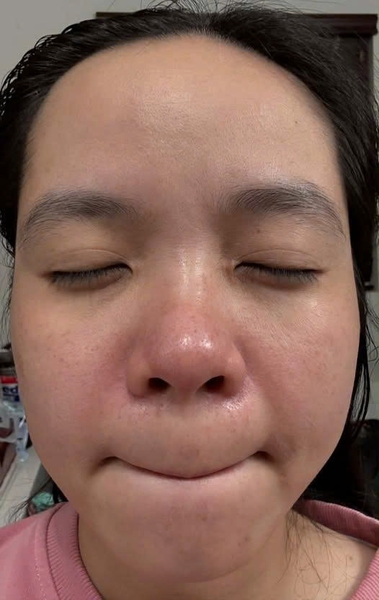 Chạm ngưỡng 35, da xuống cấp và xỉn màu thì nên bắt đầu lại từ đâu ạ?