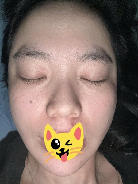 Tốn bộn tiền mua đồ review mà lỗ chân lông vẫn to, da sần sùi thì phải làm sao? 😭