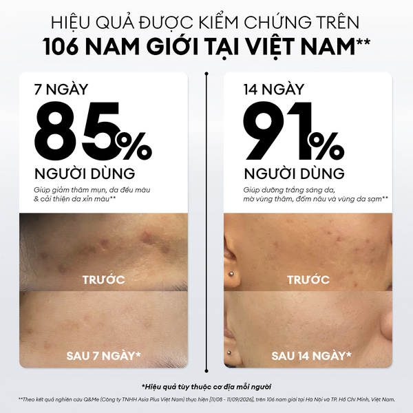 [NEW] Serum Vital Pro dưỡng trắng mờ thâm mụn 30ml