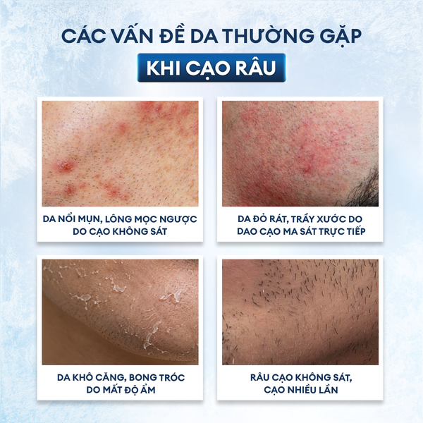 Kem cạo râu Shaving Cream 100g
