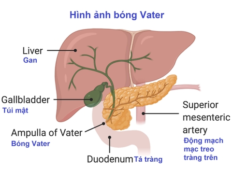 Hành trình tìm căn nguyên và điều trị bệnh Ung thư đường mật - U bóng Vater của mẹ tôi