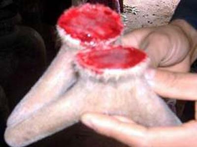 Mang bệnh vì dùng nhung hươu không đúng cách