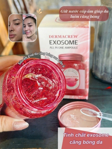 Ủ BÓNG DERMACREW EXOSOME 250ML