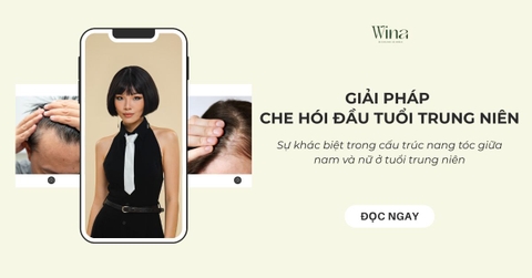 Giải Pháp Che Hói Đầu Tuổi Trung Niên: Hiểu Về Nang Tóc Để Khôi Phục Diện Mạo