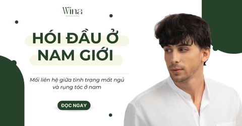 Mối Liên Hệ Giữa Tình Trạng Mất Ngủ Kéo Dài Và Tốc Độ Hói Đầu Ở Nam Giới