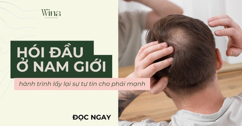 Hói Đầu Có Đáng Sợ: Hành Trình Lấy Lại Sự Tự Tin Cho Phái Mạnh