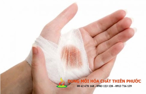 Sai lầm có thể mắc phải trong khi sử dụng Oxy già