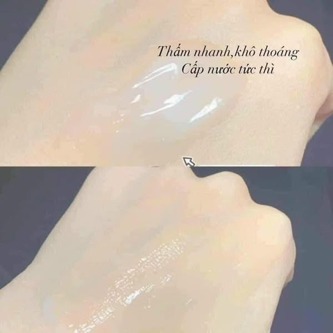 Kem dưỡng cấp ẩm Neutrogena Hydro Boost Water Gel da dầu, nhạy cảm 50ml (mẫu mới)- Pháp