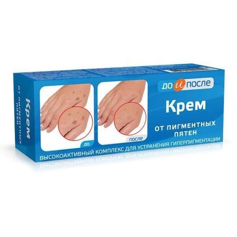 sale Kem tay KPEM trị đồi mồi, vết nám, sạm, đốm nâu da tay 50g