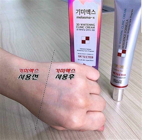 Kem trị nám tàn nhang Melasma-X 3D Whitening Clinic 35ml- Hàn