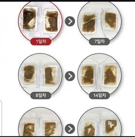 Miếng dán thải độc chân Healing Patch 30m- Hàn Quốc