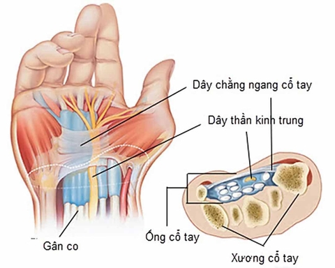 5 Cách Tập Cổ Tay Đơn Giản