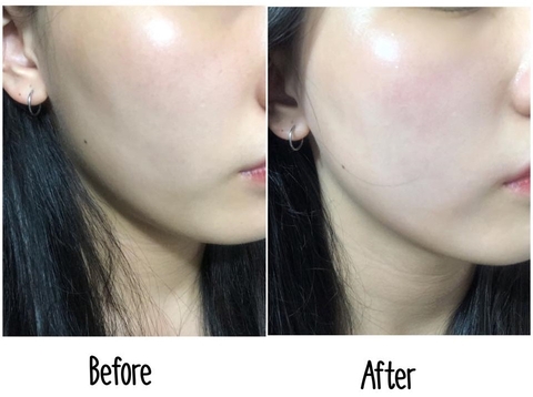 Tinh Chất Dưỡng Trắng Da Some By Mi Galactomyces Pure Vitamin C Glow Serum  30ml