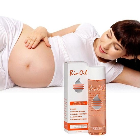 PHÒNG VÀ TRỊ RẠN DA, SẸO BIO OIL