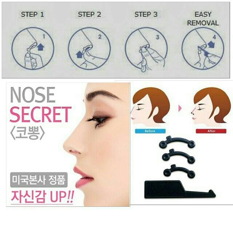 Sụn Nâng Mũi Hàn Quốc