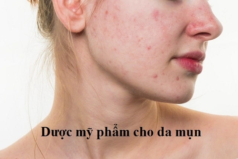 Dược mỹ phẩm cho da mụn - Thần dược cho da mịn màng