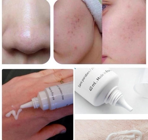  la roche posay trị thâm