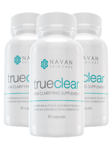 VIÊN TRUE CLEAR USA DIỆT SẠCH TẬN GỐC TẤT CẢ CÁC LOẠI MỤN CỨNG ĐẦU