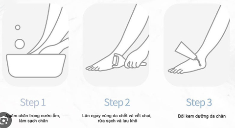 Máy mài gót chân ShowSee