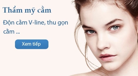 Độn cằm V-line