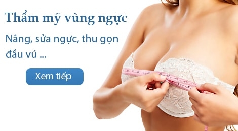 Nâng ngực Y-line