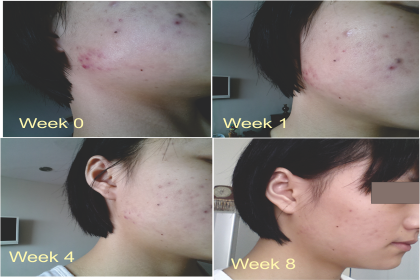 BỘ SẢN PHẨM Dr.EUZAPHIL 