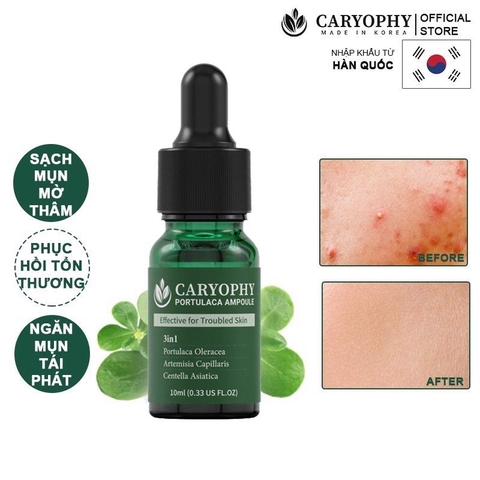 Tinh Chất Chăm Sóc Cho Da Mụn Caryophy Portulaca Ampoule 10ml
