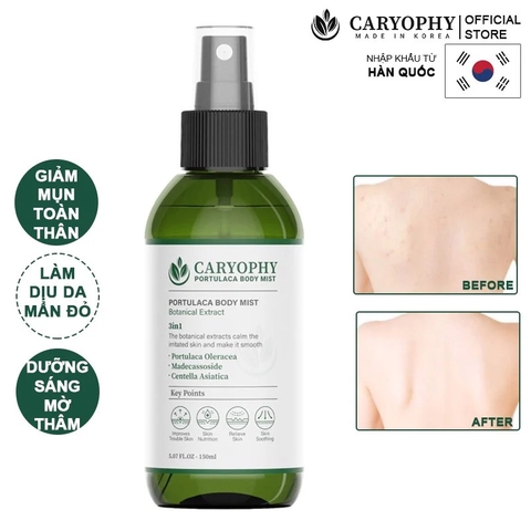 Xịt Trị Mụn Toàn Thân Caryophy Portulaca Body Mist 150ml