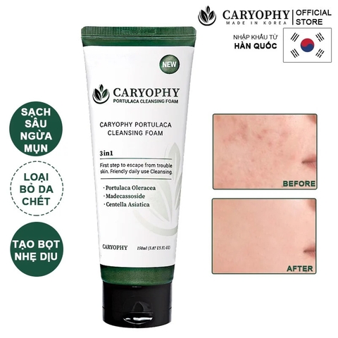 Sữa Rửa Mặt Caryophy 3In1 Ngăn Ngừa Mụn Giảm Thâm Portulaca Cleansing Foam 150ml