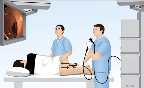 Nội soi đại tràng và những kỹ thuật mới chẩn đoán bệnh đường tiêu hóa
