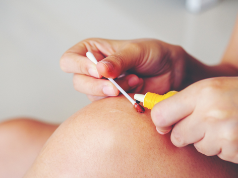 Dịch vụ rửa vết thương tại nhà TPHCM chuyên nghiệp, giá rẻ nhất