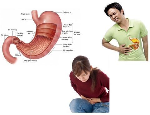 Trà dây trị dạ dày - Phương pháp mới cho người đau bệnh dạ dày