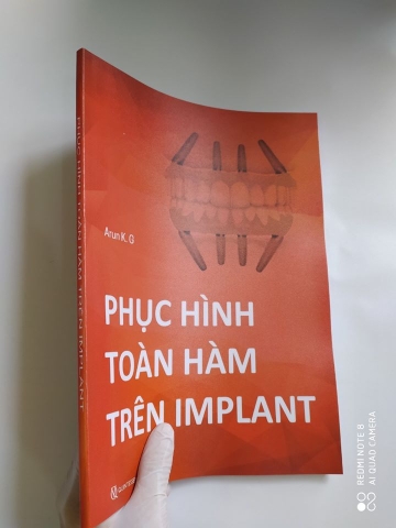 PHỤC HÌNH TOÀN HÀM TRÊN IMPLANT