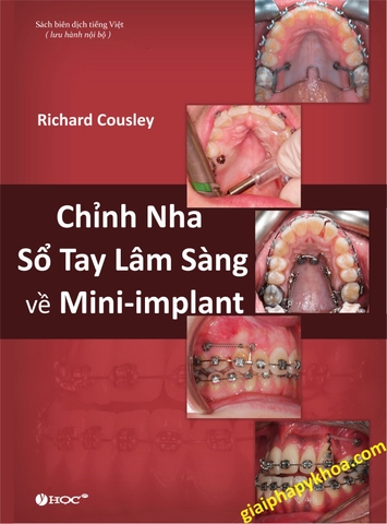 Chỉnh nha : Sổ tay lâm sàng về Mini-implant