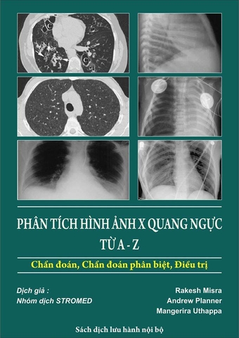 Sách phân tích hình ảnh X quang ngực từ A đến Z