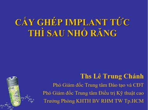 Sách cấy ghép Implant tức thì sau nhổ răng