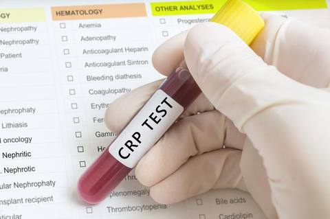Xét nghiệm CRP đánh giá tình trạng nhiễm trùng