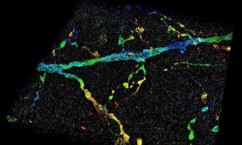 Công nghệ hình ảnh cho phép hình dung các cấu trúc nano bên trong toàn bộ tế bào
