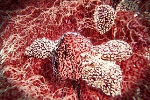 Tăng cường liệu pháp miễn dịch sản sinh nhiều tế bào chống ung thư gấp 10.000 lần