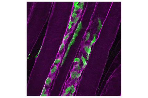 Thiếu protein laminin-α2 cản trở quá trình tái tạo cơ trong bệnh loạn dưỡng cơ hiếm gặp