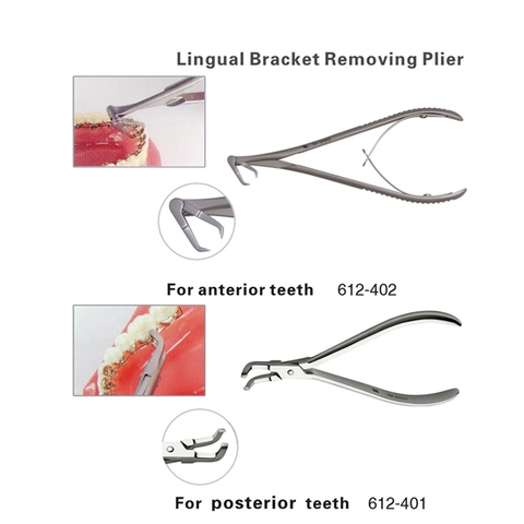 KÌM THÁO MẮC CÀIMẶT LƯỠI