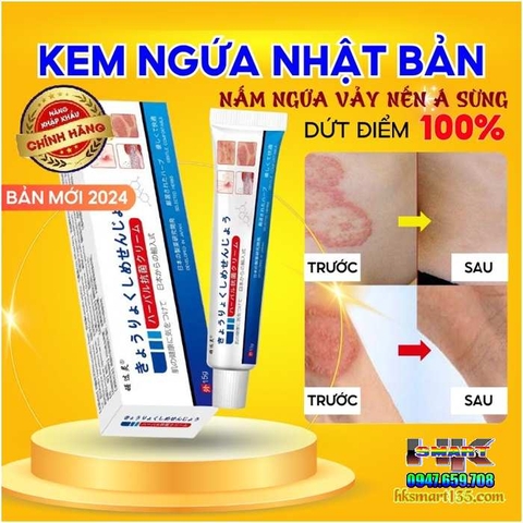 KEM BÔI ĐẶC TRỊ NẤM NGỨA VẢY NẾN Á SỪNG NHẬT BẢN [CHUẨN 100% HÀNG CTY]