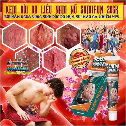 SUMIFUN 20GR- KEM BÔI DA LIỄU NAM NỮ BÔI NẪM NGỨA VÙNG SINH DỤC DO MỤN, SÙI MÀO GÀ, NHIỄM HPV...THẢO MỘC 100%