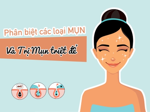 Nhận biết những loại mụn thường gặp và giải pháp khắc phục