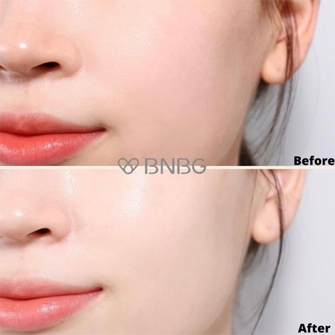 Mask BNBG Vita Derma Moisture Cream Cấp Ẩm Đa Tầng 30ml