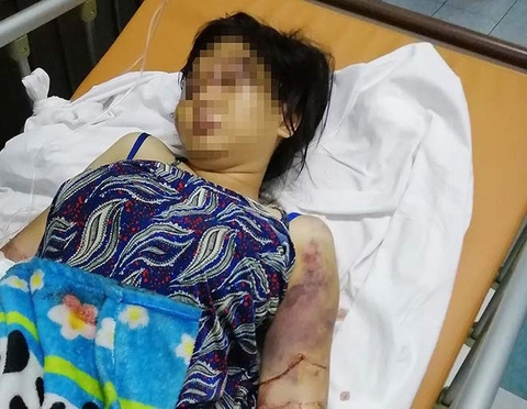 Bắt kẻ cầm đầu vụ tra tấn khiến cô gái 18 tuổi sẩy thai