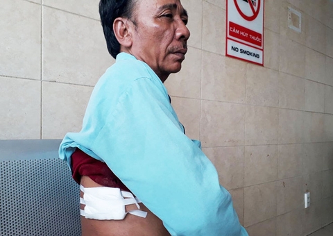 Hiệp sĩ bị cướp đâm: “Không ai dám xông vào, chúng bình thản đi”