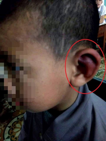 Trần tình của sư thầy bạo hành bé trai 10 tuổi thâm tím khắp người